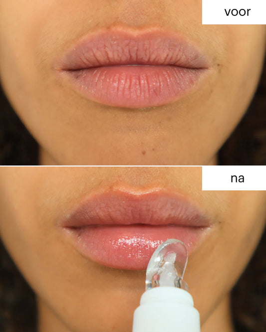 Mesoestetic® Ha Densimatrix Lips